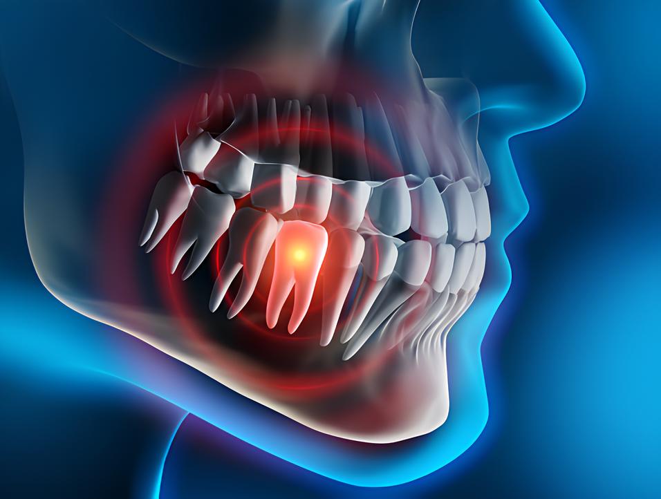 Teeth image - Emergency dentist Claygate